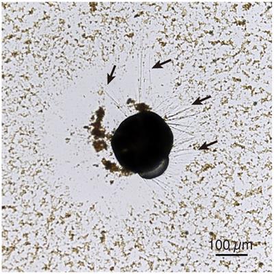 Foraminiferal detoxification breakdown induced by fatal levels of TiO2 nanoparticles